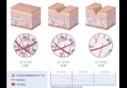 都在問的乙酰殼糖胺(NAG)功效怎么樣?功效成分的護膚品應該怎么選?